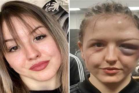 Boxer Cheyenne Hanson left with horrific swollen face after suffering gruesome head injury in..