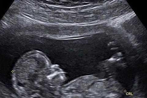 Teen Mom Ashley Jones’ baby daddy Bar Smith slammed after posting fake pregnancy announcement on..