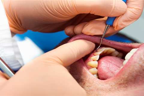 Gum disease ‘increases chance of catching Covid’ – how to tell if you’re at risk?