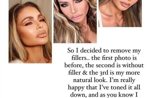 Towie’s Chloe Sims reveals she’s dissolved her lip fillers for a ‘more natural look’ and shares..