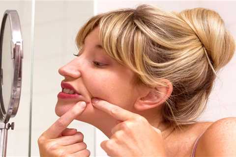Average American woman has popped over 4,000 zits in her lifetime – as wearing masks during Covid..