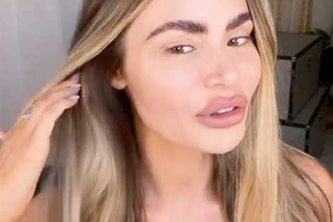 Towie’s Chloe Sims ditches makeup as she shows off natural beauty after filler removal