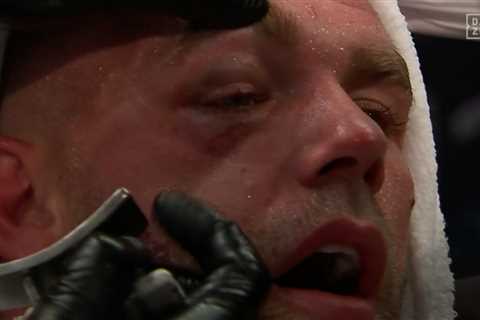 Billy Joe Saunders rushed to hospital with broken eye socket after quitting on stool during Canelo..