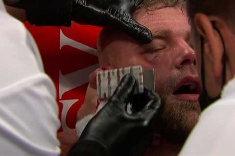 Billy Joe Saunders pre-fight comments come back to haunt him after claiming he’d rather DIE than..