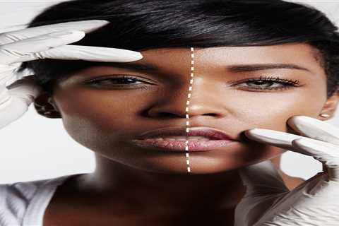 Fake tan is not racist. But Meghan Markle, skin bleaching IS