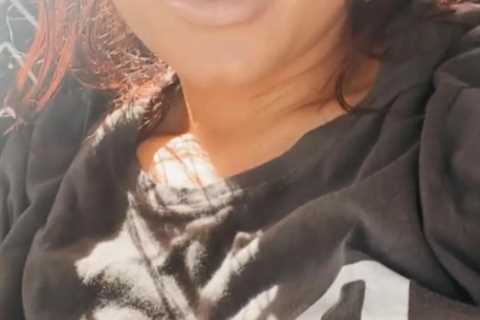 Teen Mom Chelsea Houska accused of getting ‘botched lip fillers’ as fans beg her to ‘stop’ the..