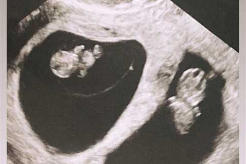 The Hills star Audrina Patridge sister reveals she’s pregnant with twins and shares sweet sonogram