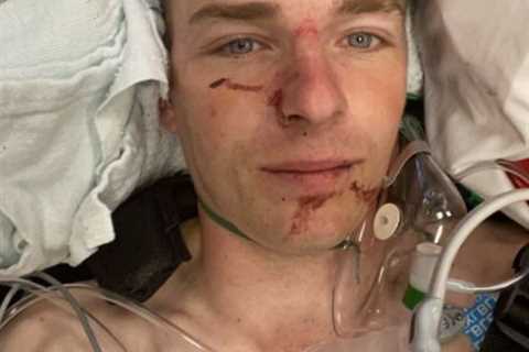 Jockey Micheal Nolan breaks back and ribs in horror fall but reassures fans he’s OK with hospital..