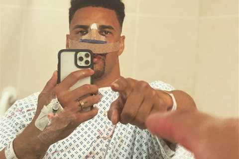 Former boxing star Anthony Ogogo undergoes TENTH eye surgery as his AEW wrestling career is paused