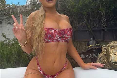 Towie’s Kelsey Stratford reveals the results of her boob job three weeks after surgery