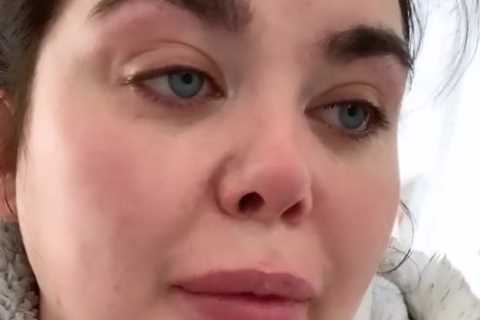 Lonely Scarlett Moffatt would sit on her own in public in desperate attempt to chat to strangers..