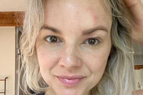 Bachelorette star Ali Fedotowsky reveals diagnosis she admits she’s been trying to ‘hide’ from fans