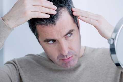 Surge in people losing their hair MONTHS after Covid infections, doc warns