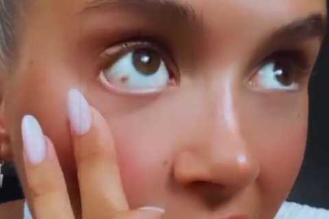 Molly-Mae Hague horrified as she shows fans ‘burst blood vessel’ in her eye