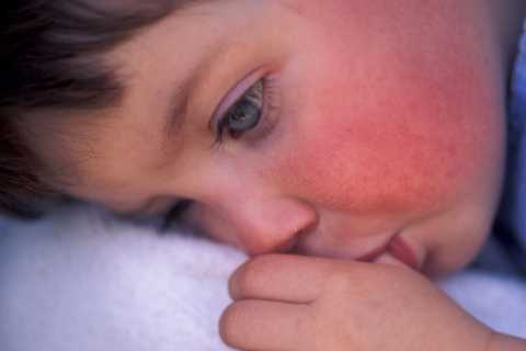 Cases of life-threatening kids’ virus rise for 8th week – as experts urge all parents to ‘be alert’