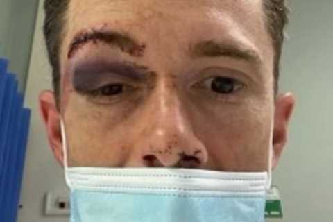 Jockey’s goggles ‘filled with blood’ and he looked ‘hideous’ after freak horseshoe smash