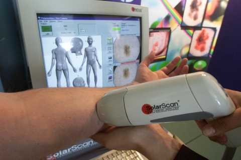 What are skin cancer symptoms and signs and what does the disease look like?