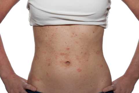 Can you spot the rashes that could be deadly? From cancer to meningitis – the signs you need to know