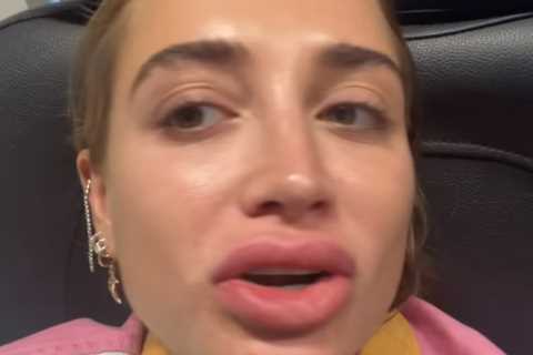 Georgia Harrison looks completely different as she has her lip fillers dissolved in very graphic..