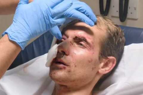 Jockey retires over blindness fears as he admits ‘I can’t see’ after horror eye injury that..