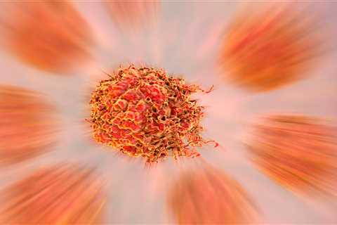 Major prostate cancer breakthrough could see patients cured in a WEEK