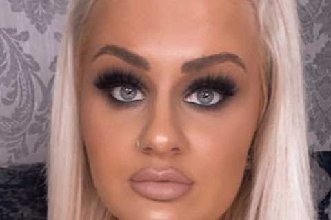 I got addicted to sunbeds to clear my eczema but was left battling killer cancer