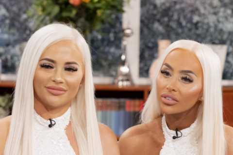 Who are plastic surgery twins Daisy and Dolly?