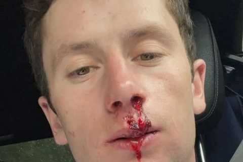 Oisin Murphy posts selfie of bloodied and battered face amid jockey title fight with William Buick