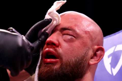 Heavyweight star Adam Kownacki banned from blowing his NOSE after fracturing skull during loss on..