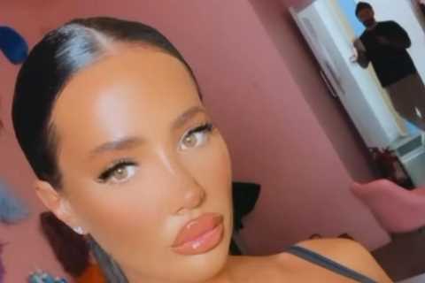 Lip fillers made me look like a duck so I’ve had them dissolved despite £11.5k of surgery, says..