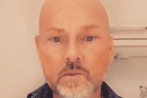 Emmerdale’s Mark Jordon appears with NO hair – and shocked fans say he looks years younger