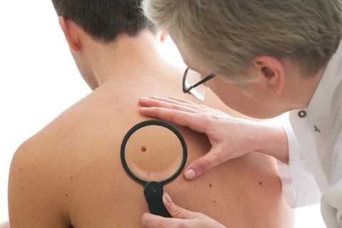 What does a cancerous mole look like?