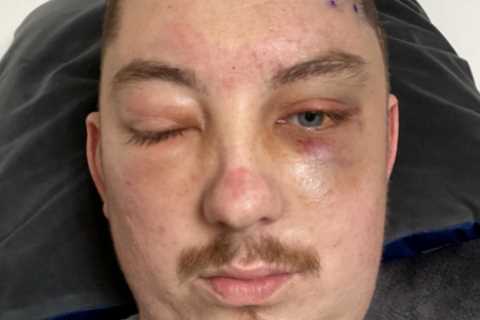 GPs sent me to Specsavers with aggressive brain cancer – now I won’t live to see my baby boy grow up