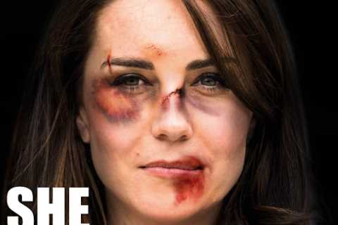 Shocking doctored pics of Kate Middleton with black eyes used for domestic violence campaign..