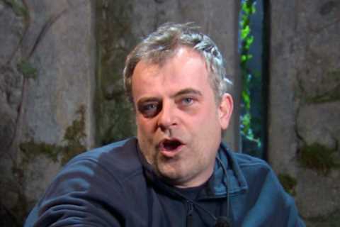 I’m A Celebrity fans predict cruel twist after Simon Gregson breaks the rules and smuggles in salt