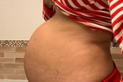Pregnant Malin Andersson shares close up photo of her ‘first stretch mark’