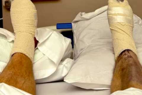 Jockey Ben Curtis reveals excruciating lengths he is going to just so he can wear shoes again..
