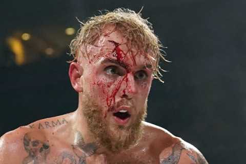 Logan Paul shows off brother Jake’s gruesome gash suffered in rematch win against ex-UFC champ..