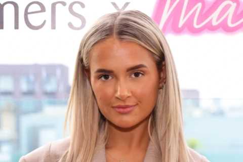 My face looked terrifying in old pics – I looked five years younger when I dissolved my fillers,..
