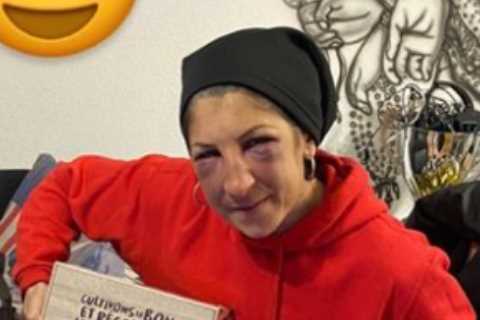 Female fighter Gutierrez shares pic of horror facial injuries after brutal Serrano beating and may..