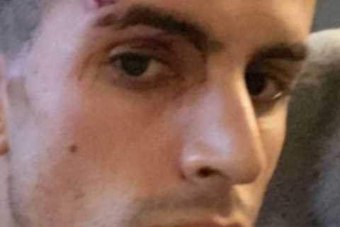 Joao Cancelo reveals horror facial injuries after being attacked by four thugs ‘who hurt me and..