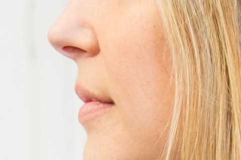 What are the symptoms of cervical cancer and how is it treated?