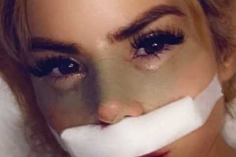 Love Island’s Hannah Elizabeth shows off brutally bruised face after surgery saying ‘new year, new..