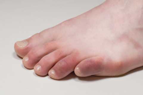 Warning over five unusual Covid symptoms that you may not know yet – and when to seek emergency..