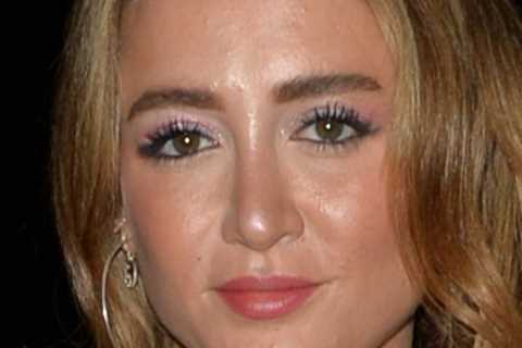 Towie star unrecognisable after getting fillers dissolved and nose job