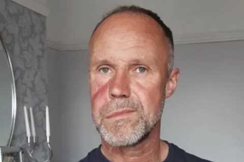 I went to my GP when water started spirting from my nose – docs said it was cancer and I could be..