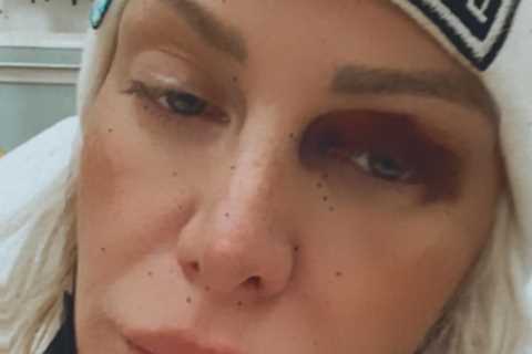 ANTM’s CariDee English rushed to hospital after suffering ‘serious head injury’ while ‘intoxicated’ ..