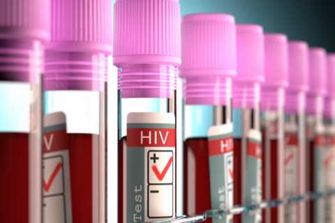 Woman is ‘cured’ of HIV after rare but risky cancer treatment