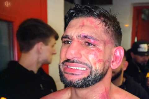 Amir Khan’s face looks battered and bruised after his brutal defeat to rival Kell Brook
