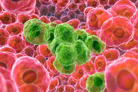 The surprising killer cancer warning sign all women need to know